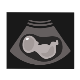 태아, 아기, 임신, 출산, 육아, baby, birth, pregnant, pregnancy, 탯줄, 산부인과, 산모, infant, 분만, 초음파, 아기초음파, ultrasound, 초음파검사, 심장소리