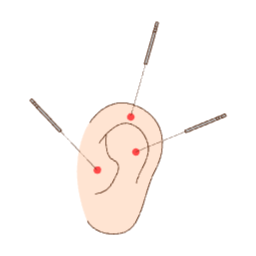 한의학, 한의원, 전통, 의술, 의학, 치료, 귀, 침, 한방, 한국, 의료, 건강, 혈자리, 침술