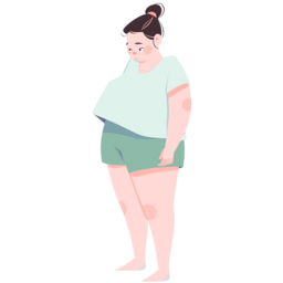 뚱뚱, 과체중, 뚱보, 돼지, 비만, 운동부족, 소아비만, 통통, 뚱뚱한, 뚱뚱한아이, 뚱뚱한어린이, 뚱뚱한사람, 게으른, 다이어트, 다이어트결심, 체중, 뱃살, 살찐, 아이비만, 과체중아이, 갱년기, 중년, 호르몬, 체중감량, 새해목표, 변신, 메이크오버, 헬스, 헬스장, 운동