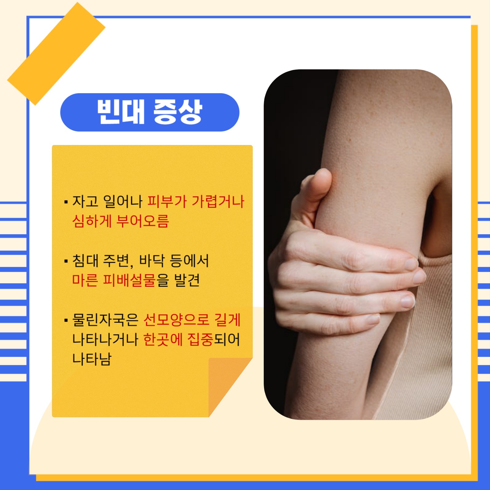 빈대 예방 꿀팁 대방출 카드뉴스