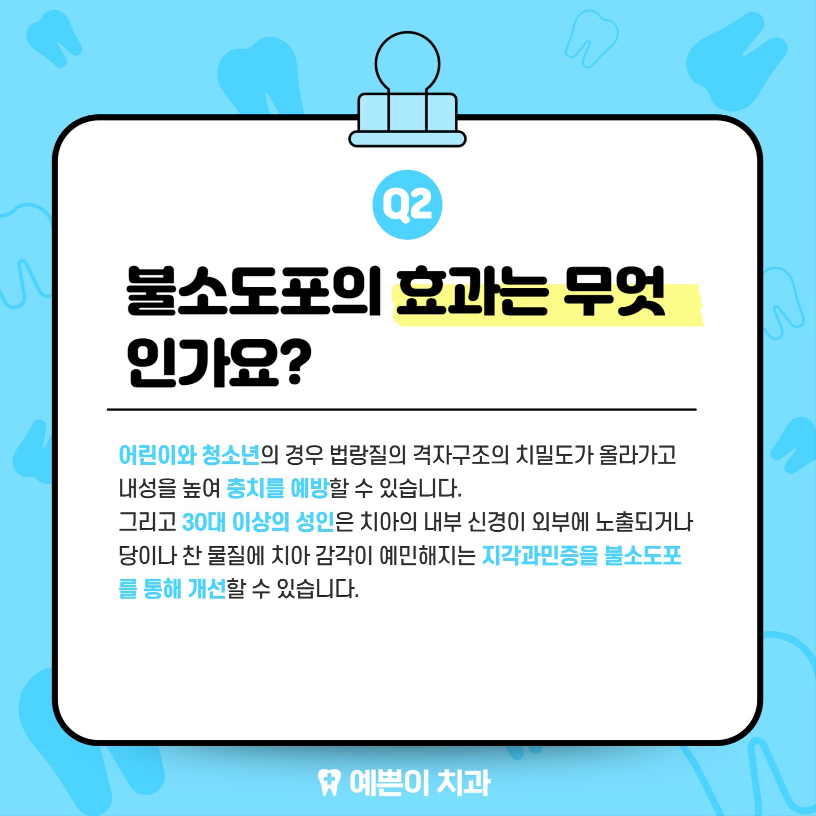 불소도포가 뭘까요?