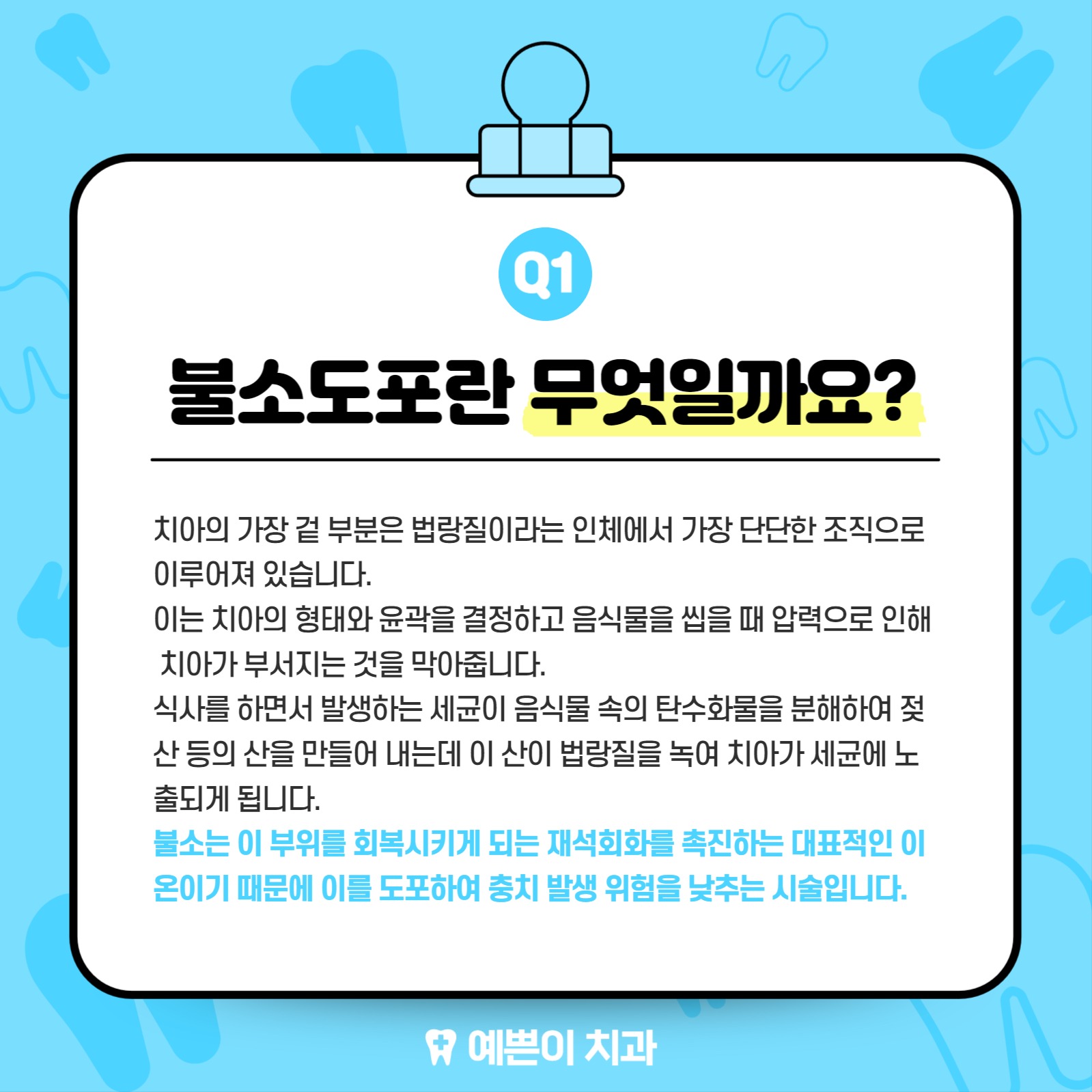 불소도포가 뭘까요?