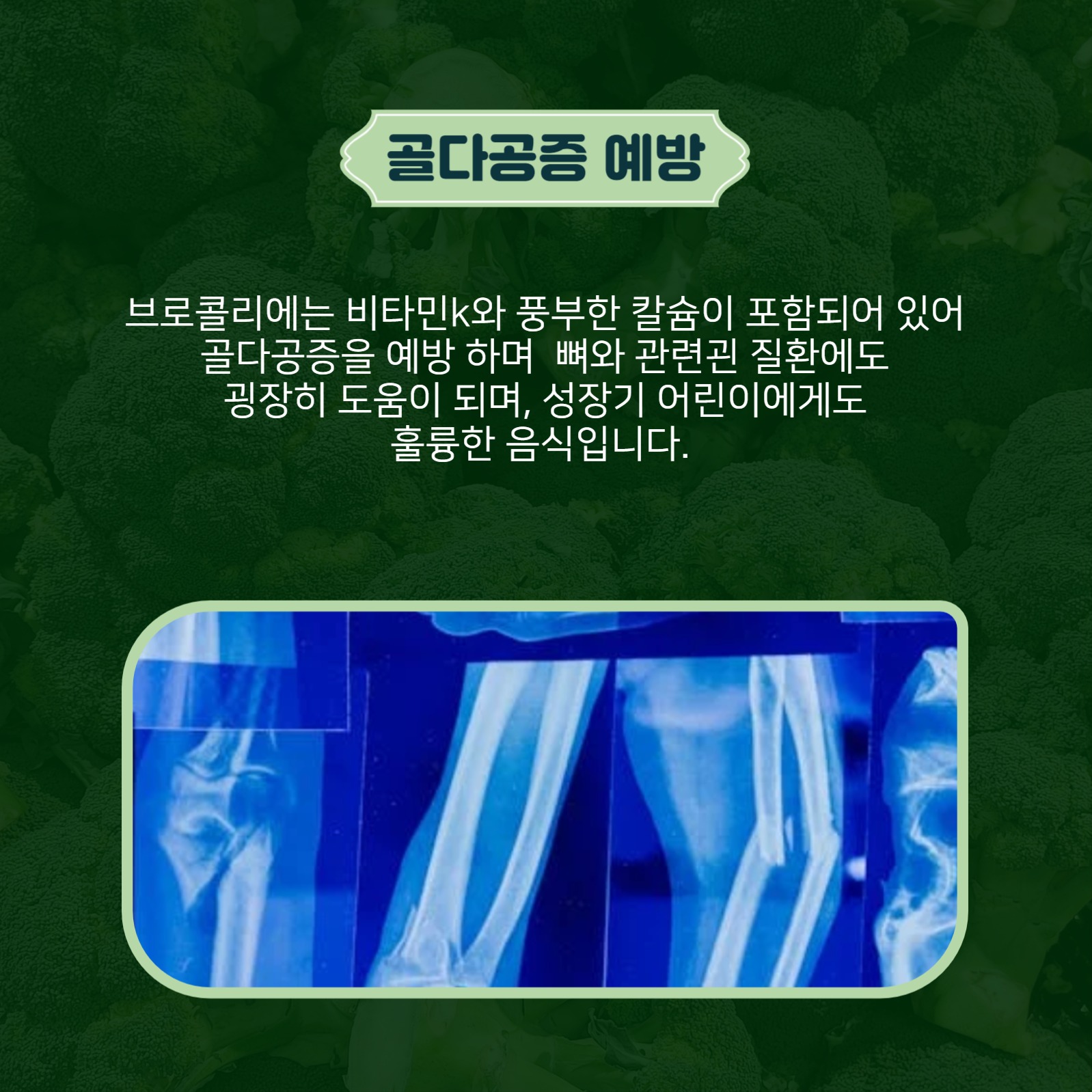 브로콜리의효능