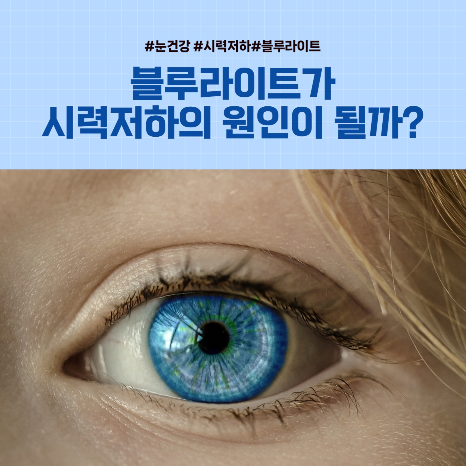 눈건강정보_블루라이트